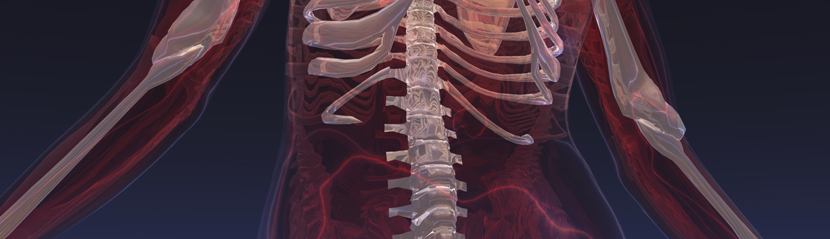 Misaligned spine needing Spine Rehab