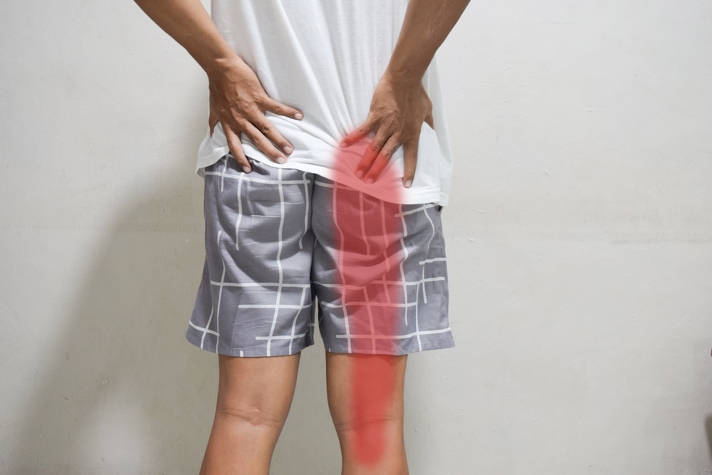 Can a Chiropractor Help with Sciatica?